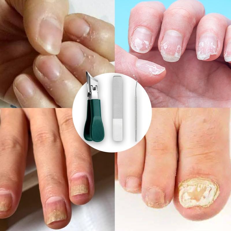 Nailux™