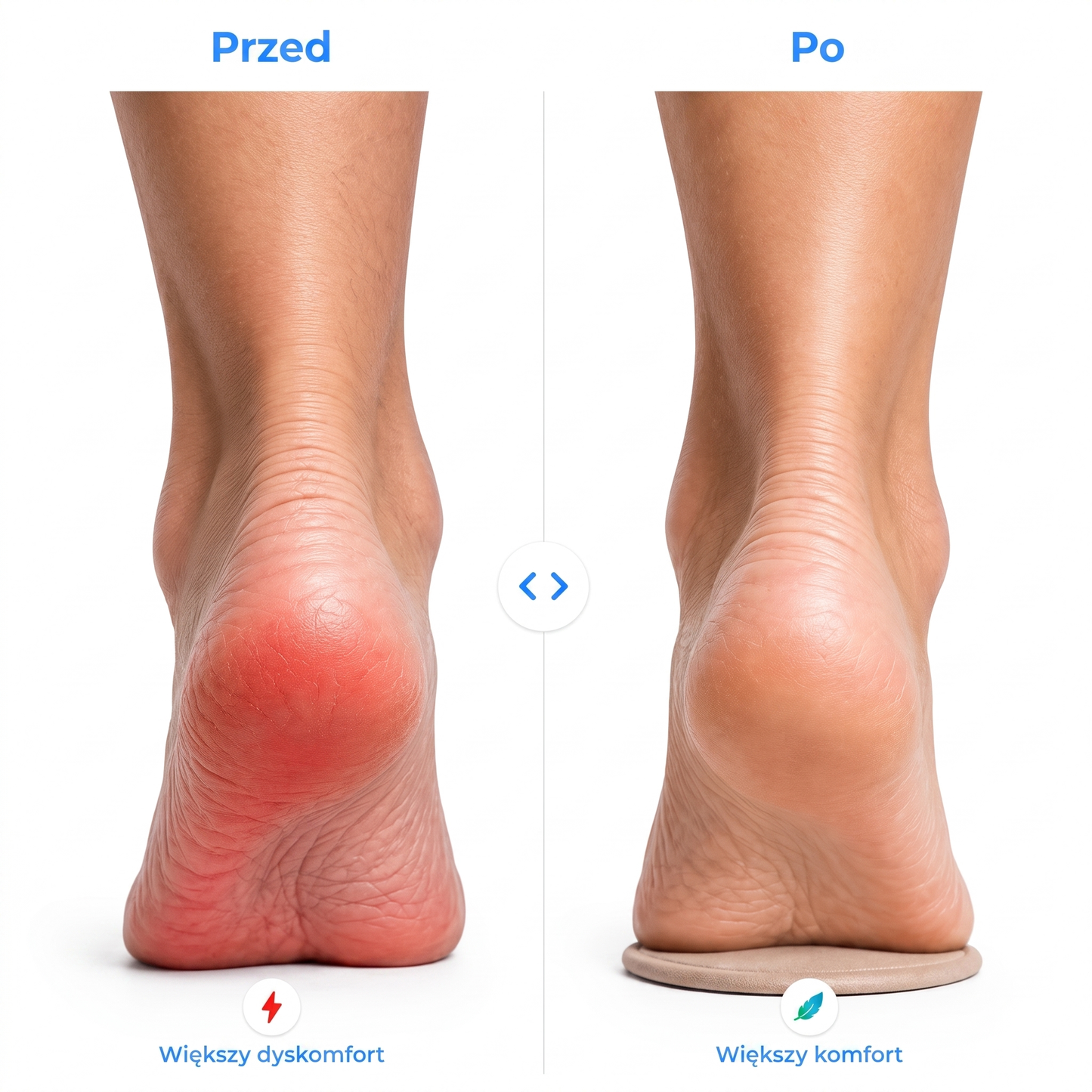 HeelRelief™